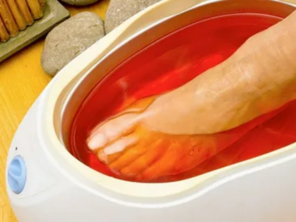 Myofascial Pain Syndrome 